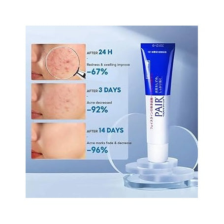 Pair Acné Cream