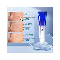 Pair Acné Cream